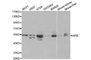 Image no. 3 for anti-Autoimmune Regulator (AIRE) antibody (ABIN3022515)