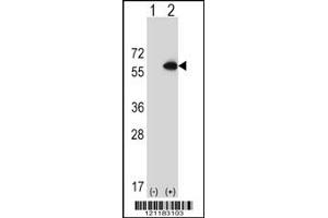 Western Blotting (WB) image for anti-Cystathionine-beta-Synthase (CBS) antibody (ABIN2158063)