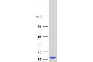 Image no. 1 for Retinol Binding Protein 5, Cellular (RBP5) protein (Myc-DYKDDDDK Tag) (ABIN2730762)
