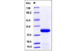 Image no. 1 for Protein Phosphatase, Mg2+/Mn2+ Dependent, 1G (PPM1G) (AA 317-546) protein (His tag) (ABIN2004149)