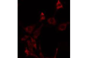 Image no. 2 for anti-Fibroblast Growth Factor Receptor-Like 1 (FGFRL1) antibody (ABIN6257077)