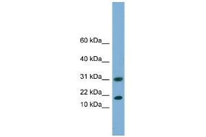 Image no. 1 for anti-Eukaryotic Translation Initiation Factor 5A2 (EIF5A2) (N-Term) antibody (ABIN2787209)