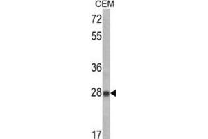 Image no. 3 for anti-Insulin-Like Growth Factor Binding Protein 6 (IGFBP6) antibody (ABIN3002791)