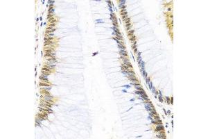 MTR4 antibody  (AA 1-304)