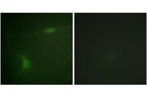 Immunofluorescence analysis of NIH-3T3 cells, using JIP1 (Phospho-Thr103) Antibody.