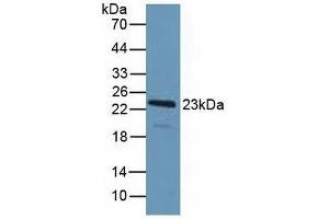 PDCD6 Antikörper  (AA 32-191)