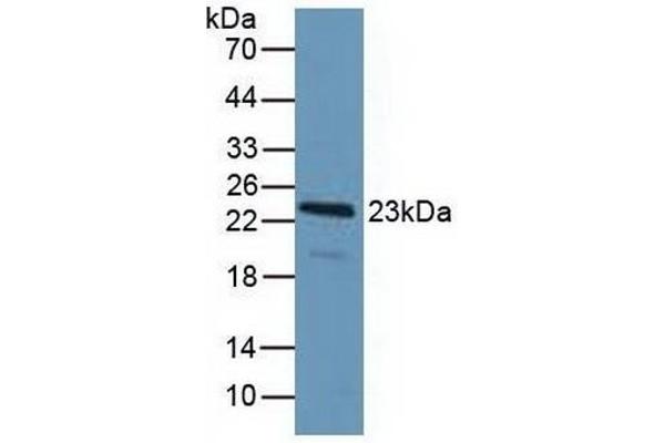 PDCD6 antibody  (AA 32-191)