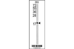 Western Blotting (WB) image for anti-Caveolin 3 (CAV3) antibody (ABIN2158059)