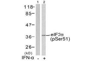 Image no. 1 for anti-Eukaryotic Translation Initiation Factor 2 Subunit 1 (EIF2S1) (pSer51) antibody (ABIN197046)