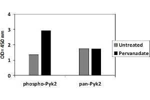 Image no. 2 for PTK2B Protein tyrosine Kinase 2 beta (PTK2B) ELISA Kit (ABIN2748576)