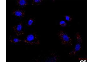 Image no. 5 for FLT1 & CRKL Protein Protein Interaction Antibody Pair (ABIN1340156)
