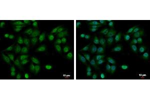 ICC/IF Image UBE2A antibody detects UBE2A protein at cytoplasm and nucleus by immunofluorescent analysis.