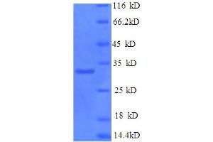 Image no. 1 for Protein Kinase, DNA-Activated, Catalytic Polypeptide (PRKDC) (AA 3747-4015) protein (His tag) (ABIN5710145)