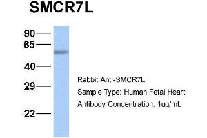 Image no. 2 for anti-Smith-Magenis Syndrome Chromosome Region, Candidate 7-Like (SMCR7L) (N-Term) antibody (ABIN2783739)