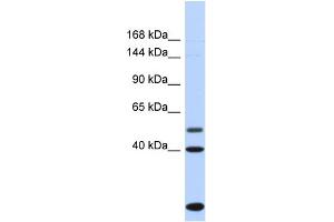Image no. 1 for anti-Pleckstrin and Sec7 Domain Containing 3 (PSD3) (C-Term) antibody (ABIN2775418)