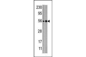 anti-60S Ribosomal Export Protein NMD3 (NMD3) (AA 410-440), (C-Term) antibody