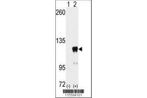 Image no. 1 for anti-Pumilio Homolog 2 (Drosophila) (PUM2) (AA 159-189) antibody (ABIN392131)