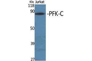 Western Blot (WB) analysis of specific cells using PFK-C Polyclonal Antibody.