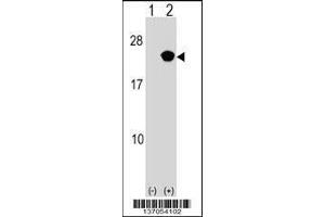 Image no. 2 for anti-RAP2B, Member of RAS Oncogene Family (RAP2B) (AA 102-129) antibody (ABIN1537716)