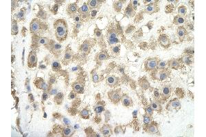 Rabbit Anti-GPC3 antibody        Paraffin Embedded Tissue:  Human Placenta cell   Cellular Data:  Epithelial cells of renal tubule  Antibody Concentration:   4.