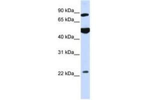 Image no. 1 for anti-Mannosyl-Oligosaccharide Glucosidase (MOGS) (AA 144-193) antibody (ABIN6740983)
