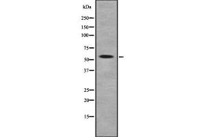 Image no. 1 for anti-Plexin Domain Containing 2 (PLXDC2) (Internal Region) antibody (ABIN6264312)