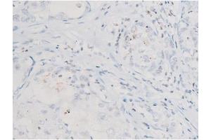 Image no. 7 for anti-Spleen tyrosine Kinase (SYK) (pTyr525) antibody (ABIN6255944)