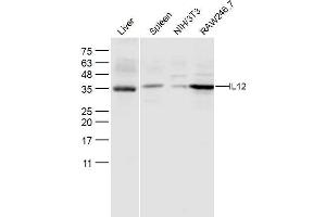 Image no. 3 for anti-Interleukin 12 alpha (IL12A) (AA 51-150) antibody (ABIN672951)