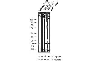 Image no. 4 for anti-Stathmin 1 (STMN1) (pSer25) antibody (ABIN6255120)