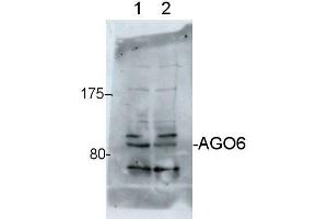 Western Blotting (WB) image for anti-Argonaute 6 (AGO6) antibody (ABIN619533)