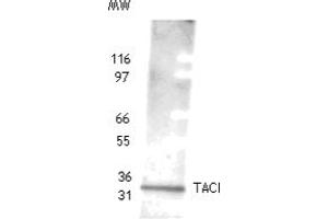 Image no. 1 for anti-Tumor Necrosis Factor Receptor Superfamily, Member 13B (TNFRSF13B) (AA 116-132) antibody (ABIN6972839)