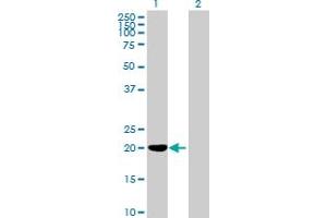 Image no. 1 for anti-Lysozyme-Like 2 (LYZL2) (AA 1-194) antibody (ABIN530460)
