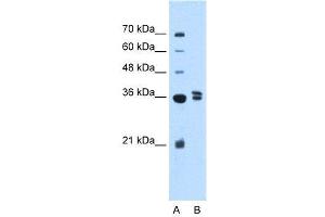 Image no. 2 for anti-Transcription Factor B1, Mitochondrial (TFB1M) (Middle Region) antibody (ABIN2775860)