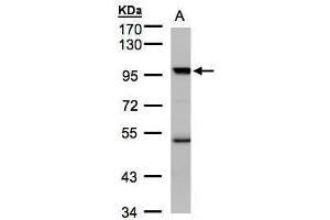 Image no. 2 for anti-K(lysine) Acetyltransferase 2B (KAT2B) (C-Term) antibody (ABIN2856697)