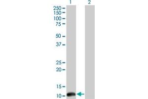 Image no. 5 for anti-Cleavage Stimulation Factor, 3' Pre-RNA, Subunit 3, 77kDa (CSTF3) (AA 1-103) antibody (ABIN560513)