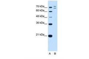 Image no. 2 for anti-Ring Finger Protein 168 (RNF168) (AA 401-450) antibody (ABIN6739167)