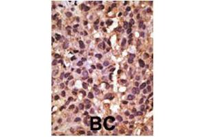 Immunohistochemistry (IHC) image for anti-BCL2/adenovirus E1B 19kDa Interacting Protein 3 (BNIP3) (N-Term) antibody (ABIN2159577)