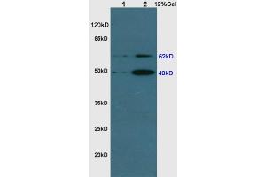Image no. 5 for anti-Sequestosome 1 (SQSTM1) (AA 51-150) antibody (ABIN682153)