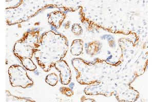 Image no. 3 for anti-Tumor-Associated Calcium Signal Transducer 2 (TACSTD2) (AA 1-274), (Extracellular Domain) antibody (ABIN1996785)