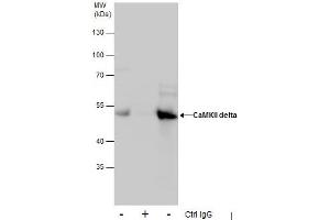 Image no. 3 for anti-Calcium/calmodulin-Dependent Protein Kinase II delta (CAMK2D) (Center) antibody (ABIN2856806)