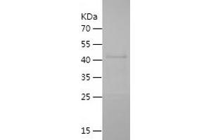 Zona Pellucida Glycoprotein 3 Protein (ZP3) (AA 183-386) (His-IF2DI Tag)