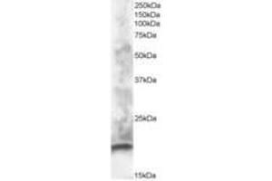 Image no. 1 for anti-S100 Calcium Binding Protein G (S100G) (AA 2-13) antibody (ABIN296789)