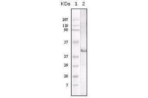 Image no. 1 for anti-Lipase A, Lysosomal Acid, Cholesterol Esterase (LIPA) antibody (ABIN969484)
