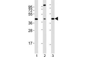 Image no. 1 for anti-SRY (Sex Determining Region Y)-Box 17 (SOX17) (AA 350-400) antibody (ABIN3029031)
