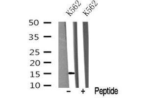 Image no. 1 for anti-Vesicle-Associated Membrane Protein 4 (VAMP4) (N-Term) antibody (ABIN6265945)