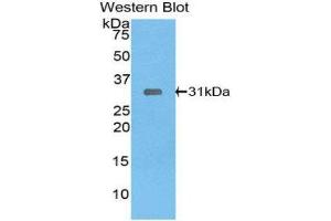 Image no. 1 for anti-LIM and Senescent Cell Antigen-Like Domains 1 (LIMS1) (AA 68-303) antibody (ABIN1859667)