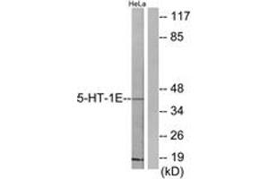 Image no. 1 for anti-Serotonin Receptor 1E (HTR1E) (AA 101-150) antibody (ABIN1534240)