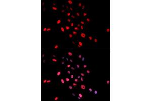 Image no. 2 for anti-Jun Proto-Oncogene (JUN) (pSer63) antibody (ABIN3023571)