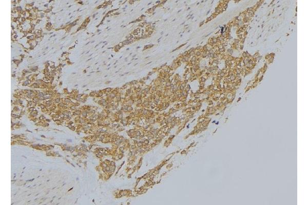 MICAL1 antibody  (Internal Region)
