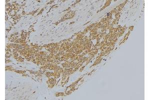 MICAL1 antibody  (Internal Region)